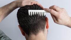 Hair surgeon points out the worst enemy of summer hair: “It’s the fault of seasonal effluvium”