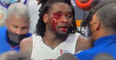 LeBron James golpea en la cara a Isaiah Stewart y acaba expulsado