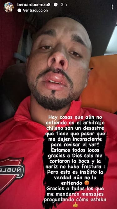 “Los árbitros chilenos son un desastre; ¿me tienen que dejar inconsciente para que vean el VAR?”