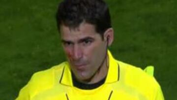 Un asistente de Clos Gómez, alcanzado por un paraguas