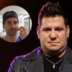 Un cirujano habla sobre la nariz de Lucas y su posible operación: “Nariz en silla de montar”