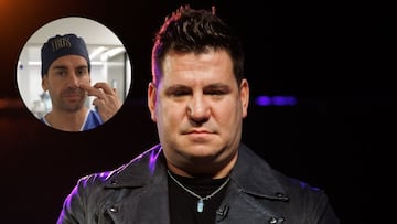 Un cirujano habla sobre la nariz de Lucas y su posible operación: “Nariz en silla de montar”