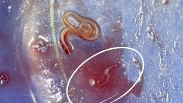 Un chef se pone a limpiar unos boquerones y lo que se encuentra le lleva adoptar un cambio radical en su rutina