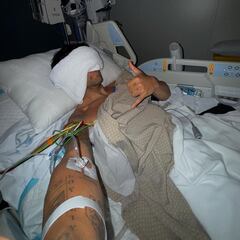 Último parte de Jorge Martín: ¡11 costillas rotas!