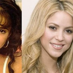 El antes y el después de Shakira: más de 63.000 euros en retoques estéticos