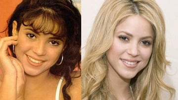 El antes y el después de Shakira: más de 63.000 euros en retoques estéticos