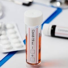 Sanidad aprueba los test antígenos: efectividad y diferencias con otras pruebas