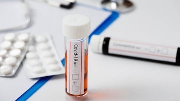 Test Covid-19
QUIRÃNSALUD
22/09/2020