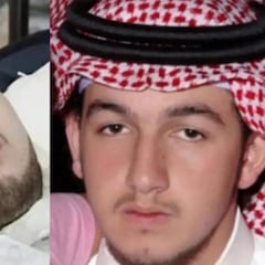 Muere el “príncipe durmiente”: llevaba 20 años en coma