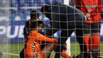 Tomeu Nadal sufre fractura de los huesos propios de la nariz