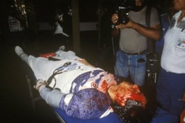 In 1989, Chile keeper Roberto Rojas feigned injury when a flare was thrown onto the pitch during a World Cup qualifying match against Brazil. Television replays showed that the flare had not made contact with Rojas and the keeper subsequently admitted he