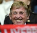 Kenny Dalglish recibe el alta tras dar positivo en coronavirus
