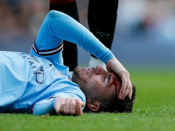 El central español del Manchester City se ha golpeado la cabeza con el codo del jugador del Brentford FC Ethan Rupert Pinnock. Al de Agen ha sido atendido sobre el terreno de juego durante cuatro minutos ya que la hemorragia no cesaba. Le han tenido que vendar la cabeza. 