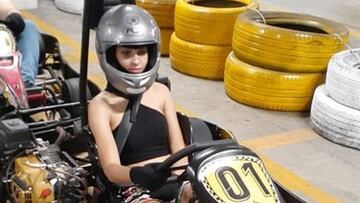 Una chica pierde su cuero cabelludo en un accidente de kart