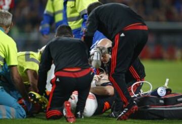 Las imágenes de la fractura de tibia de Luke Shaw