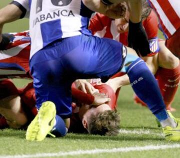 Torres suffered the worst injury of his career against Deportivo La Coruña. He was knocked out cold in a tackle with Bergantiños.