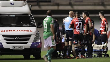 Capitán de Antofagasta deberá ser operado por golpe en el ojo