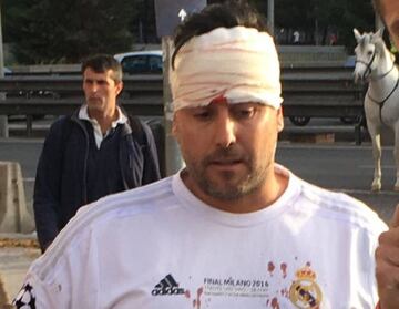 An injured Real Madrid fan outside the Calderón