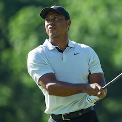 "Nunca más tendré movilidad total y siempre va a doler"