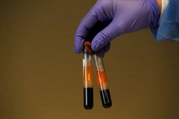 A phlebotomist shows to the camera specimens of people getting tested for coronavirus antibodies at the Refuah Health Center on April 24, 2020 in Spring Valley, New York