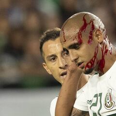 Luis 'Chaka' Rodríguez sufrió golpe que lo hizo sangrar de la cabeza