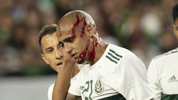 El defensa mexicano sufrió un golpe por parte de Bazile, el cual le ocasionó aparatosa cortada que lo hizo sangrar de inmediato. A pesar de ello, continuó en el campo.