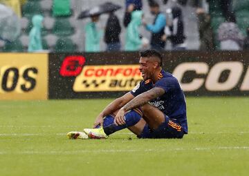 El jugador del Real Madrid ha sufrido una aparatosa caída durante el partido de liga ante el Elche, que le ha supuesto una rotura en la nariz que le hará pasar por el quirófano.