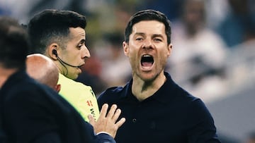 “No entiendo nada de la gestión de la lesión de Mbappé”