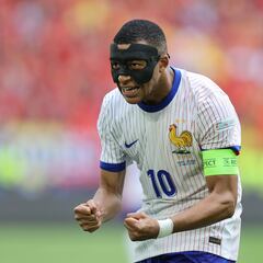 Mbappé: su nariz tiene remedio