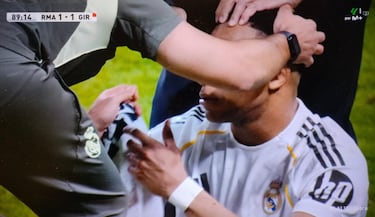 La sangre de Mbappé no se vio en TV por la ausencia de un plano claro