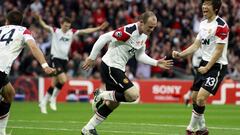 Los futbolistas que se han hecho injerto capilar