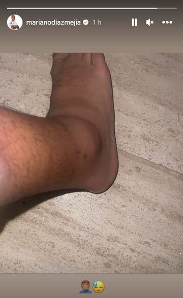 El tobillo de Mariano Díaz, tras sufrir un esguince leve en un entrenamiento.