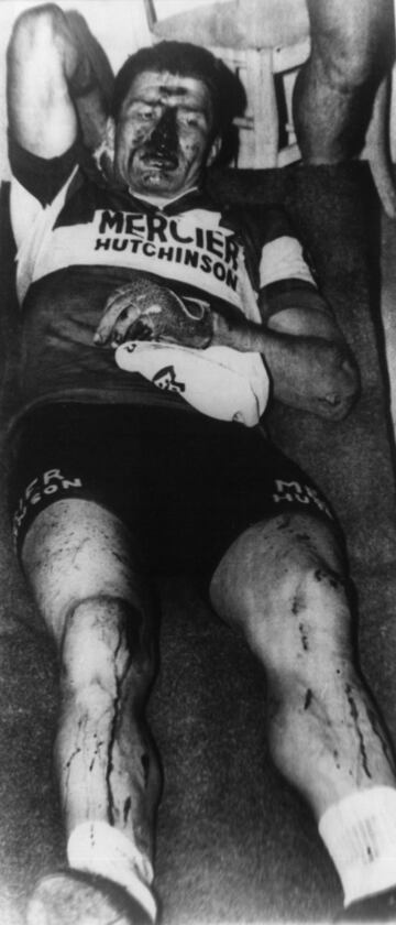 Poulidor tras su caida en el Tour 1968. El 14 de julio, Día Nacional de Francia, en la etapa con llegada en Albi, una moto de prensa provocó un accidente en cadena que golpeó en la rueda Poulidor y acabó con el francés en el asfalto sufriendo heridas en el rostro, codos y rodillas.