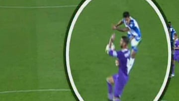 Mano de Sergio Ramos