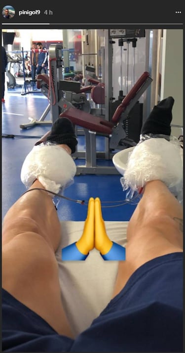 Las escasas variantes que tiene la U para armar su ataque