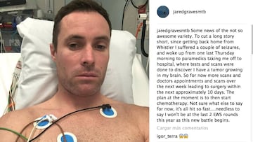 Post de Jared Graves en Instagram anunciando que sufre un tumor cerebral.