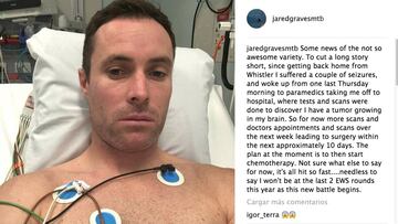 Post de Jared Graves en Instagram anunciando que sufre un tumor cerebral.