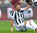 Mala suerte para Gonzalo Higuaín: se lesionó ante el Torino