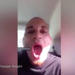 El rapero Kasper Night se dispara en la mejilla y lo sube a Facebook