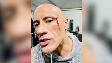 La Roca se hace una herida entrenando y su reacción se ha hecho viral en redes