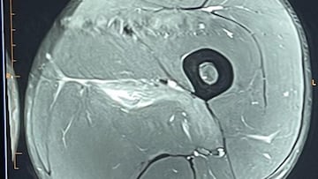 Djokovic sale al paso de las críticas por su lesión: “Para los ‘expertos’”