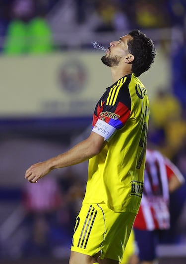 América carga con las lesiones de Henry Martín