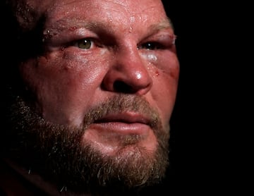 El BKB (Bare-knuckle boxing) es el deporte del boxeo sin el uso de guantes de boxeo u otro acolchado en las manos de los participantes.