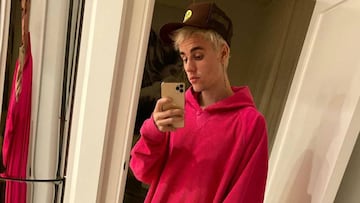 Preocupación por el estado físico de Justin Bieber tras su reaparición