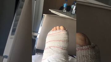 El primer video de Bravo tras su compleja operación