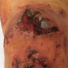 Una ciclista muestra la dureza del ciclocross en sus piernas