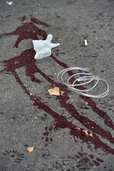 Lamentablemente, el ataque en Bataclan causó 90 muertos y un gran número de heridos, siendo el punto con más víctimas de toda la noche de atentados en París.