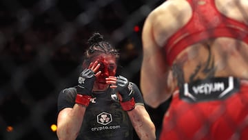 LAS VEGAS, NEVADA - SEPTEMBER 14: (L-R) Irene Aldana of Mexico fights Norma Dumont of Brazil during UFC 306: Riyadh Season Noche at Sphere on September 14, 2024 in Las Vegas, Nevada. Christian Petersen/Getty Images/AFP (Photo by Christian Petersen / GETTY IMAGES NORTH AMERICA / Getty Images via AFP)