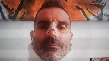 Sorrentino: traumatismo y nariz rota tras chocar con Cristiano