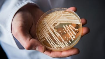 CDC labels drug-resistant fungus an ‘urgent threat’